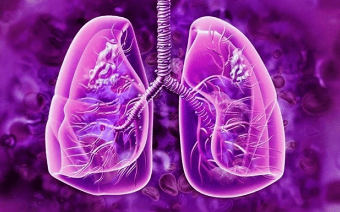 Exploring Cannabis’ Relationship to Lung Cancer