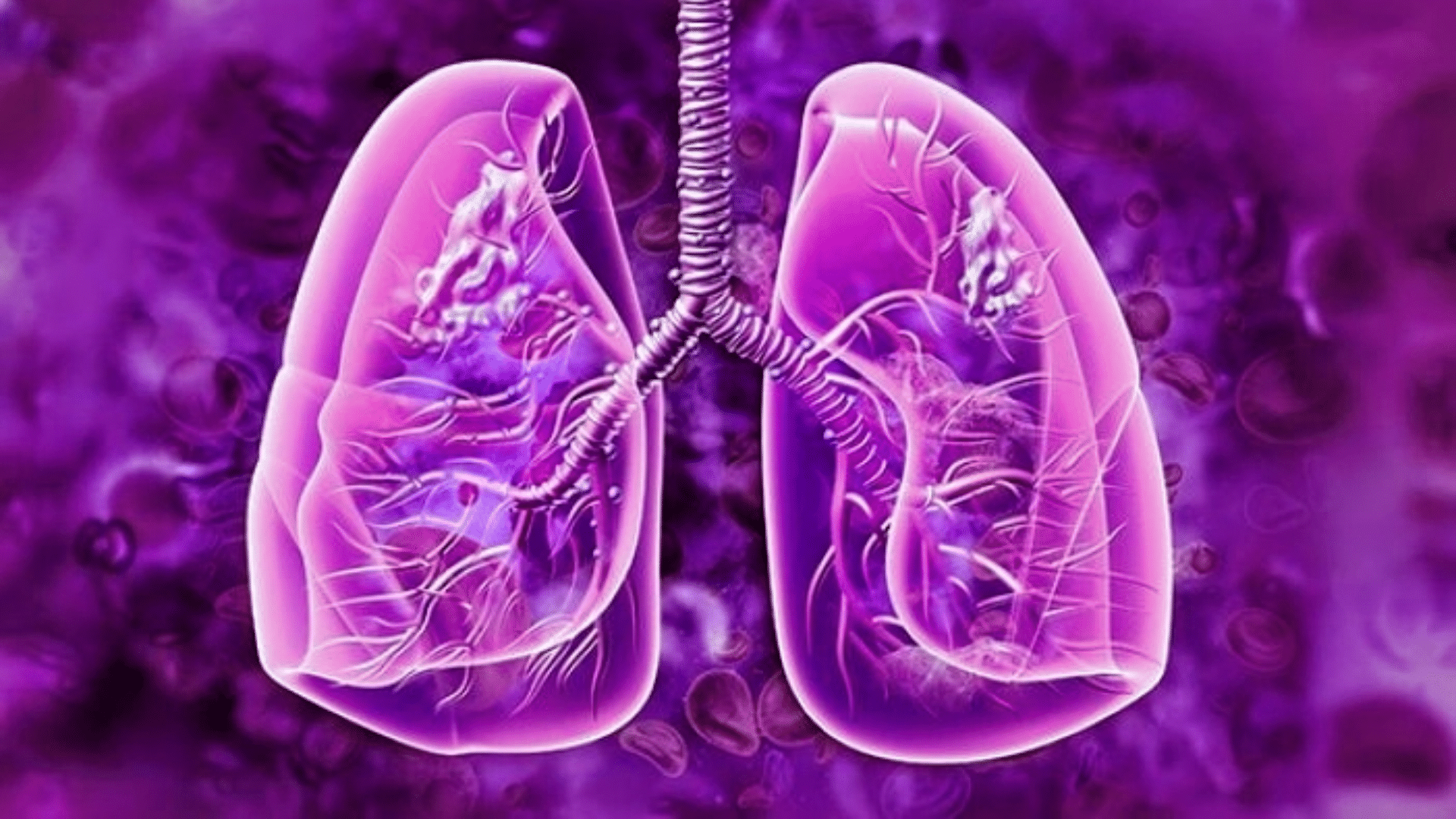 Exploring Cannabis' Relationship to Lung Cancer